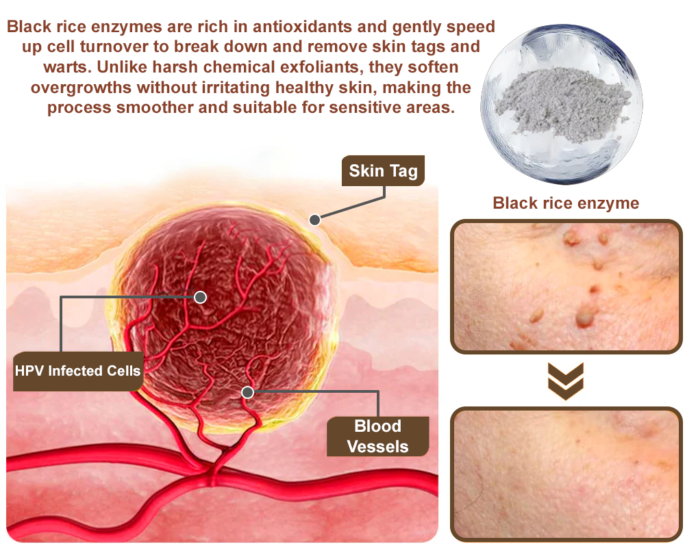 Black Rice Skin Repair Essence Cream ⚕️ FDA Certified (Removes warts and skin growths, improves keratin buildup and seborrheic dermatitis, follicular keratosis, age spots, and bruising)