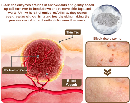 Black Rice Skin Repair Essence Cream ⚕️ FDA Certified (Removes warts and skin growths, improves keratin buildup and seborrheic dermatitis, follicular keratosis, age spots, and bruising)