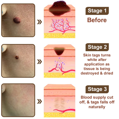 Black Rice Skin Repair Essence Cream ⚕️ FDA Certified (Removes warts and skin growths, improves keratin buildup and seborrheic dermatitis, follicular keratosis, age spots, and bruising)