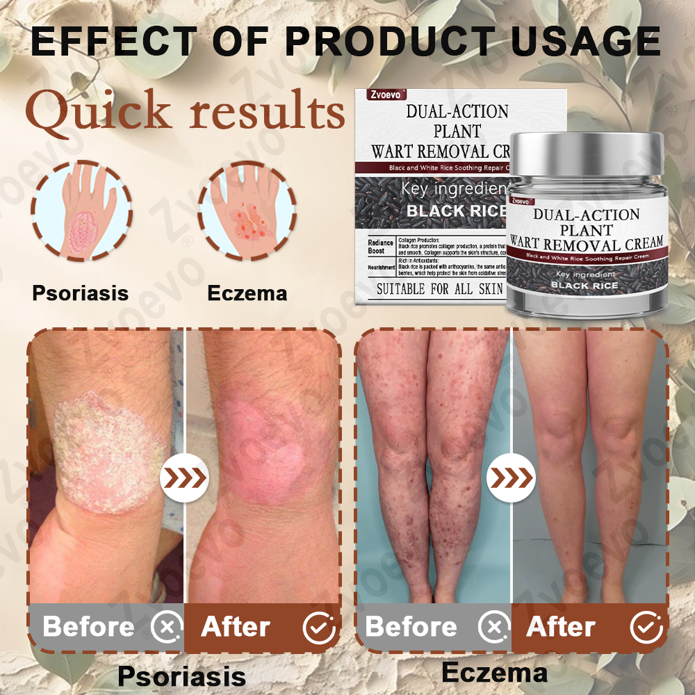 Black Rice Skin Repair Essence Cream ⚕️ FDA Certified (Removes warts and skin growths, improves keratin buildup and seborrheic dermatitis, follicular keratosis, age spots, and bruising)