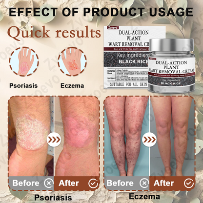 Black Rice Skin Repair Essence Cream ⚕️ FDA Certified (Removes warts and skin growths, improves keratin buildup and seborrheic dermatitis, follicular keratosis, age spots, and bruising)